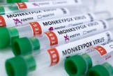 Thêm quốc gia ở châu Á ghi nhận có ca mắc bệnh đậu mùa khỉ