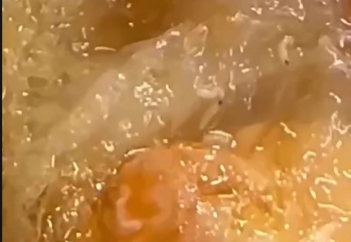 Thanh niên mua hộp xôi phát hiện dòi lúc nhúc bên trong, chủ cơ sở nói do không kiểm tra kỹ