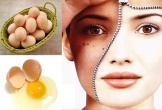 Hiệu quả bất ngờ khi trị nám bằng trứng gà