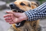 Bé trai 3 tuổi bị chó dại cắn đứt nửa bên lưỡi