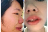 Vụ phụ huynh hành hung nữ giáo viên do con mất cơ hội xét tuyển đại học: Cơ quan công an vào cuộc