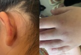Vụ nữ sinh bị lột đồ, đánh hội đồng suốt 2 giờ: Nhóm thiếu nữ thừa nhận đánh bạn