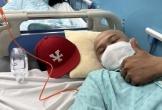 Tình hình hiện tại của rapper Long Nón Lá: Đang nhập viện để chuẩn bị hóa trị đợt 3, mỗi lần như vậy sức khỏe lại yếu đi