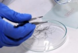 Cô gái mang tóc của 4 người đàn ông đi xét nghiệm ADN, kết quả khiến tất cả bất ngờ