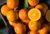 Quả cam được mệnh danh là vua Vitamin C với 7 công dụng tuyệt vời cho sức khỏe