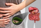 Vì sao người bị bệnh sỏi mật không nên ăn thực phẩm nhiều dầu mỡ?
