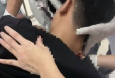 Nghệ An: Xô xát khi múa lân, thiếu niên bị n.ém vật nhọn vào mặt gây trọng thương