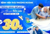 Ứng dụng công nghệ hiện đại trong trồng răng Implant tại Bệnh viện Thái Thượng Hoàng