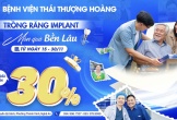Ứng dụng công nghệ hiện đại trong trồng răng Implant tại Bệnh viện Thái Thượng Hoàng