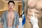 Chàng trai Trung Quốc tiêm axit để tạo cơ bụng 6 múi hoàn hảo