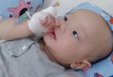 Bé trai 6 tháng tuổi bị viêm tủy cột sống, nguy cơ bại liệt