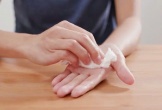 Ra mồ hôi tay, coi chừng dấu hiệu bệnh lý