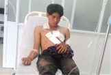 Nổ mìn tự chế khi đi đánh cá, 2 người bị thương nặng