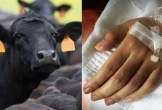 Thái Lan ghi nhận ca tử vong đầu tiên do bệnh than sau 30 năm, theo dõi 638 người