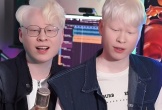 Cặp song sinh bạch tạng hiếm gặp ở Hà Tĩnh sau 12 năm nổi tiếng
