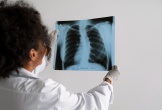 Một lý do khiến nhiều người Việt mắc COPD