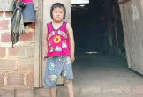 Cháu gái mắc bệnh hiểm nghèo