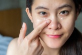 6 cách giảm bọng mắt, quầng thâm cho dân văn phòng không cần can thiệp xâm lấn