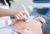 Đề xuất phạt 100 triệu nếu chọn giới tính thai nhi