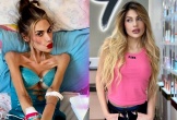 KOL Thổ Nhĩ Kỳ giảm 40 kg trong 2 năm, qua đời khi chỉ còn 22 kg