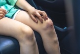 Dấu hiệu cảnh báo đường ruột có thể chứa đầy độc tố