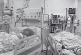 Hai chị em nhập viện trong tình trạng nguy kịch vì bị phóng hỏa