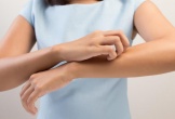 4 loại ngứa báo hiệu bệnh tật khác nhau, cần cảnh giác