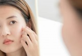 Bí quyết chăm sóc da mụn ẩn tại nhà để lấy lại vẻ ngoài mịn màng