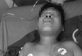 Sức khỏe nạn nhân sống sót vụ thảm án tại Đắk Lắk tạm thời ổn định