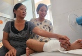 Ghép bàn tay vào chân cho cô gái 18 tuổi mang song thai để chờ ngày nối lại