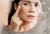 Không muốn cơ thể lão hóa nhanh và rước bệnh vào người, tránh xa ngay 5 loại thực phẩm này
