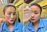 Gương mặt sưng vù của hot girl bóng đá sau va chạm