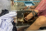 Người đàn ông vác cả máy xay thịt đến bệnh viện cấp cứu