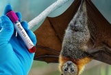 Việt Nam chưa ghi nhận ca nhiễm virus Nipah, Bộ Y tế siết chặt phòng dịch