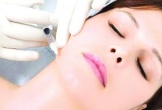 Tiêm botox mức độ an toàn và cảnh báo biến chứng