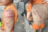 Lý do người cha đánh con 10 tuổi bầm tím khắp người
