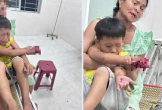Cháu bé bị dập bàn tay nghi do điện thoại nổ lúc sạc pin