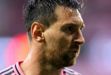 Messi không chấn thương, chỉ bị căng cơ và giữ chân cho World Cup