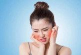 Cách xử lý da cháy nắng và chọn kem chống nắng an toàn