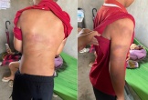 Nghệ An: Mẹ tố cha ruột b.ạo h.ành con trai 10 tuổi