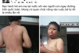 Công an vào cuộc vụ mẹ tạt nước sôi lên người con trai